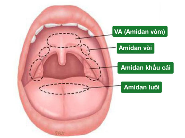 Có nhiều loại Amidan khác nhau