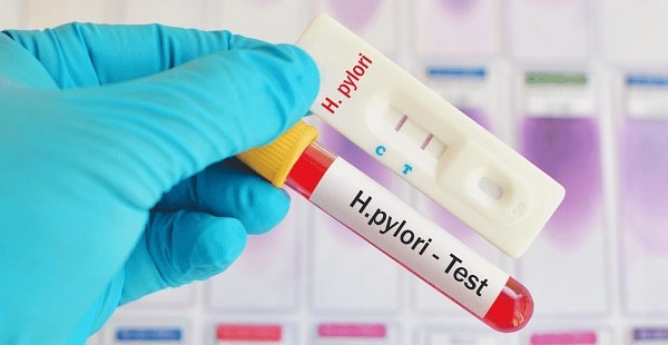 Khi phát hiện có dấu hiệu của nhiễm khuẩn Hp cần thực hiện xét nghiệm để điều trị trong thời gian sớm nhất