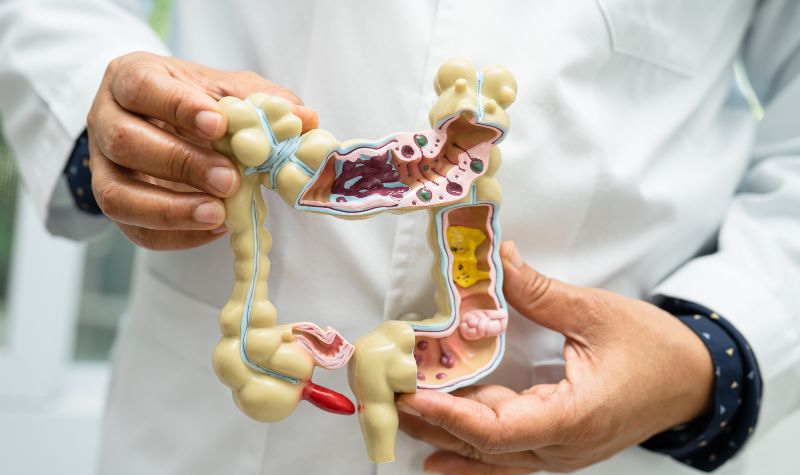 Rối loạn hệ tiêu hóa
