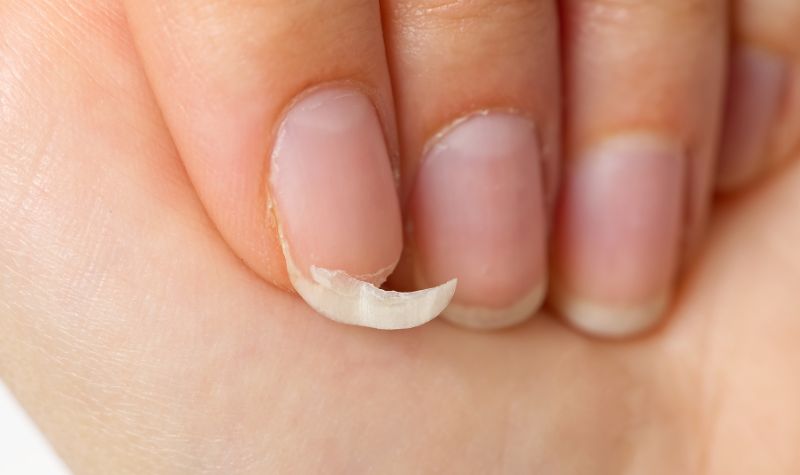 Da và móng bắt đầu thay đổi