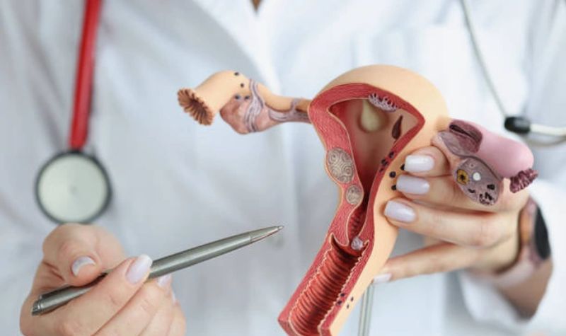 Các giai đoạn phát triển của ung thư buồng trứng