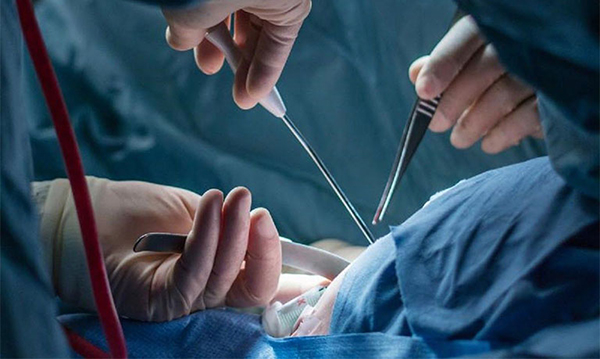 Phẫu thuật trị ung thư buồng trứng