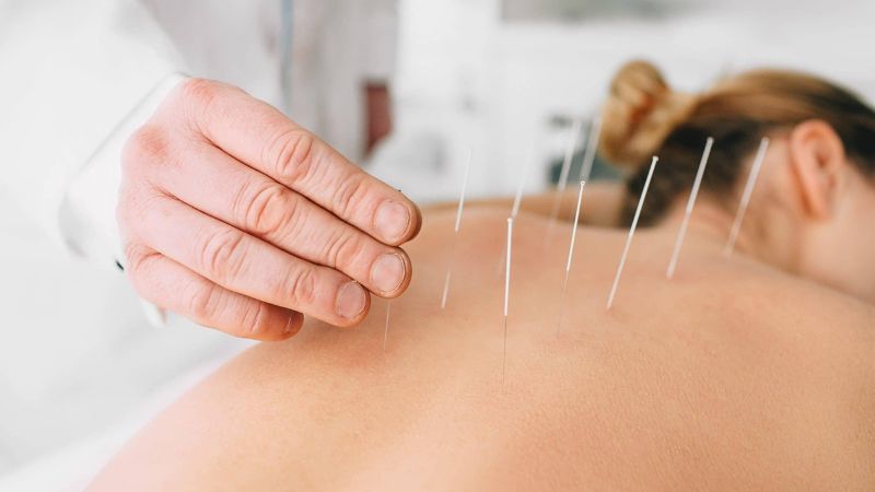 Phương pháp điều trị bệnh đám rối thắt lưng
