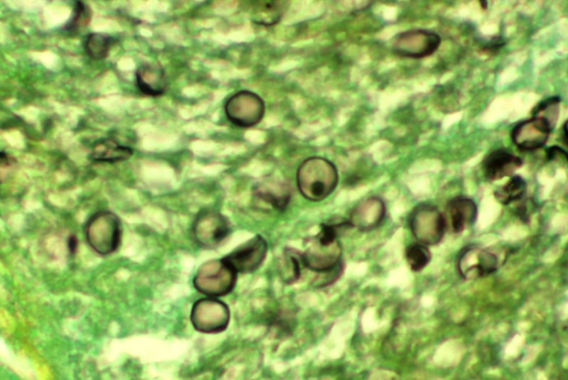 Pneumocystis Jiroveci