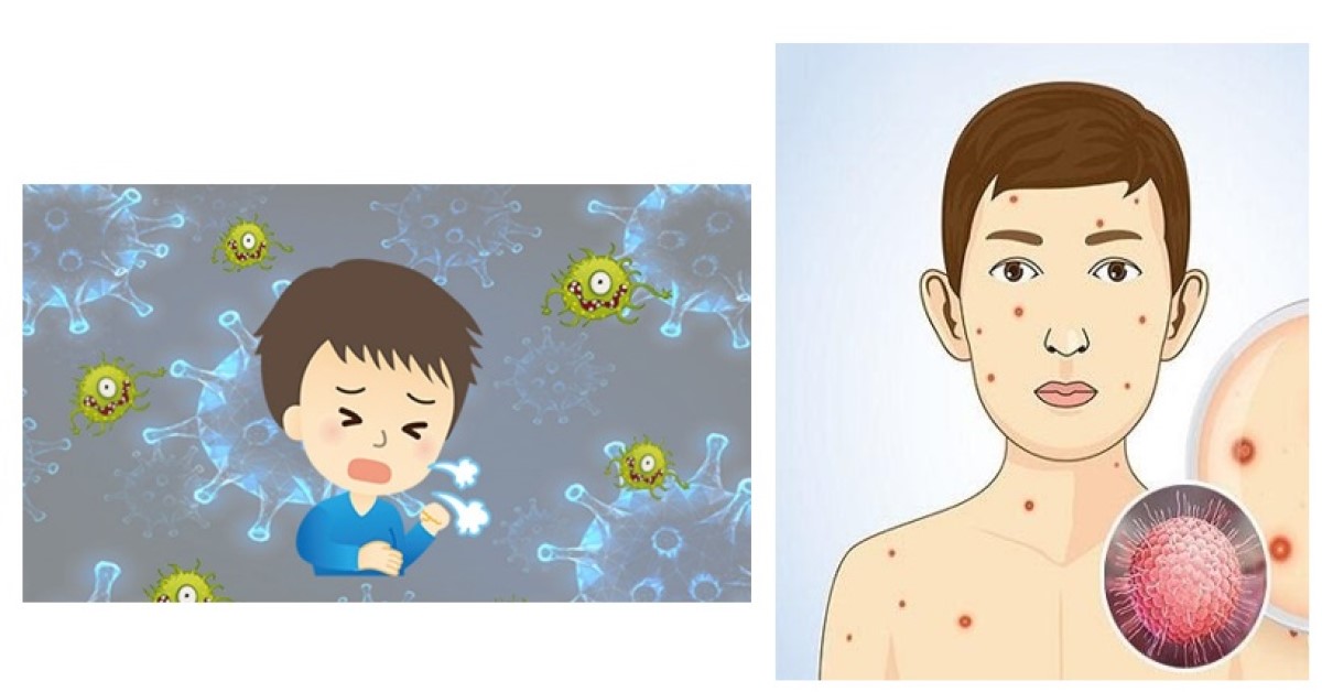 bệnh cơ hội là gì