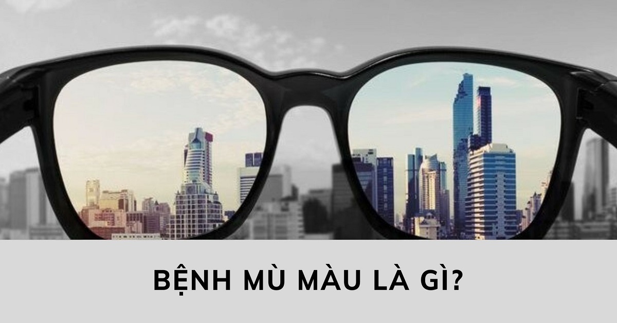 benh-mu-mau-la-gi