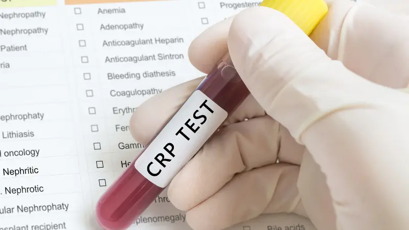 Cần chú ý khi chỉ số CRP tăng cao