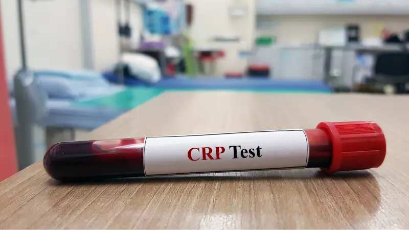 Xét nghiệm CRP cho biết tình trạng sức khỏe
