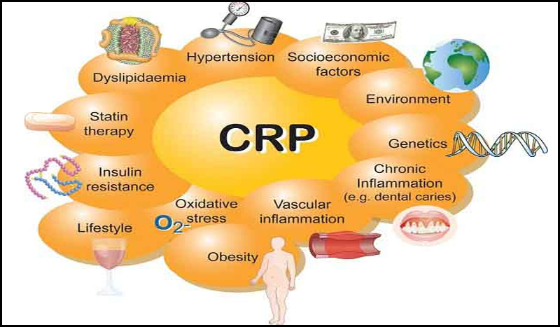 Tiến hành xét nghiệm CRP và cách đọc các chỉ số CRP