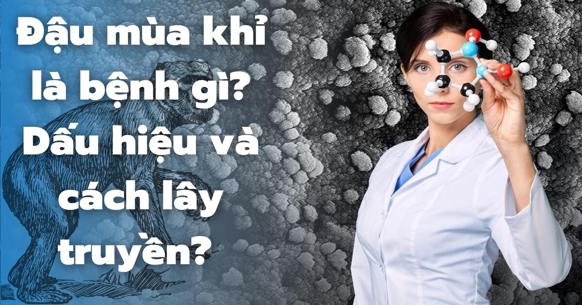Đậu mùa khỉ là bệnh gì? Đậu mùa khỉ có thật sự nguy hiểm không?