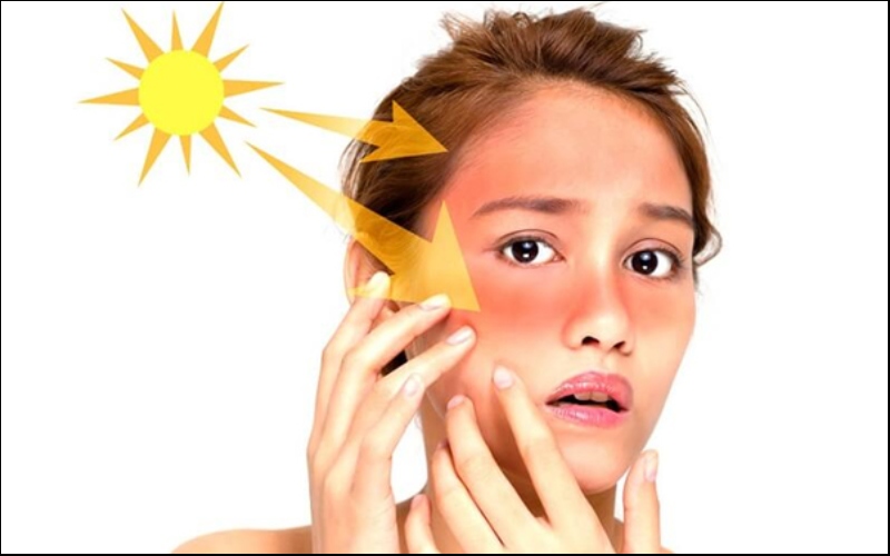 Phơi nắng nhiều có thể gây ra hiện tượng cháy nắng