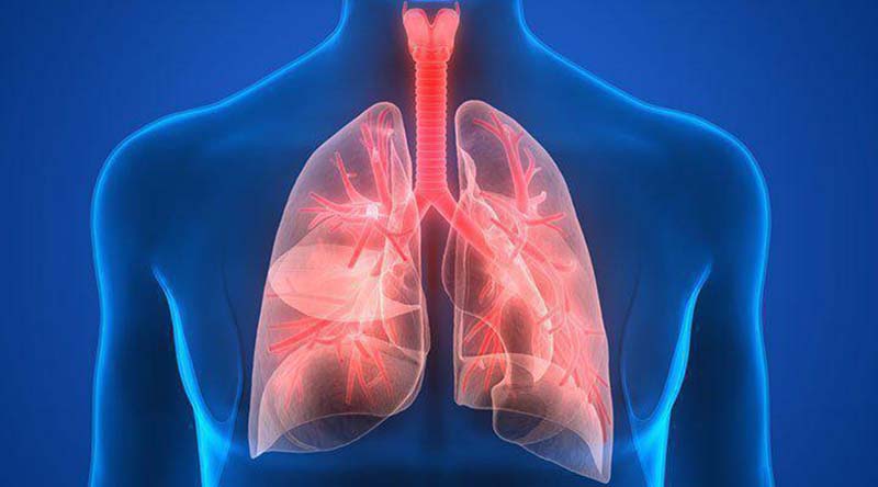 Một số câu hỏi liên quan đến Pneumonia là gì?