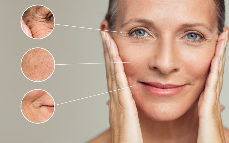 Tia UVA gây nên các vấn đề lão hóa da