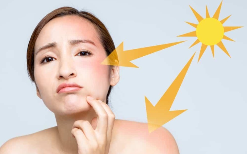 Tia UVB ảnh hưởng đến bề mặt da
