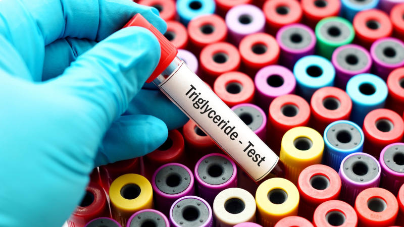 Triglyceride trong máu là gì?