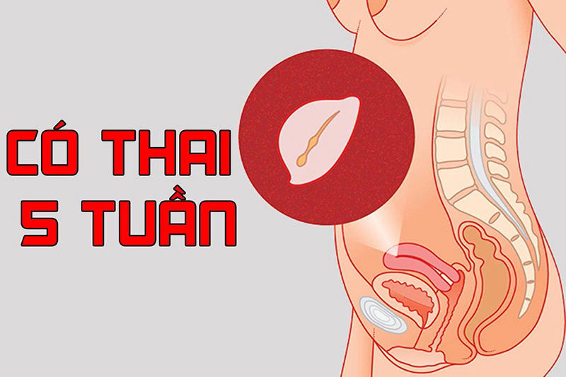 Tìm hiểu về Yolksac là gì? Túi thai có Yolksac là gì?