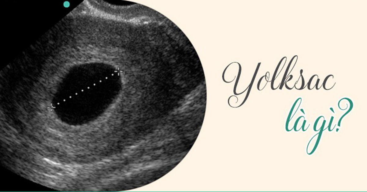 Yolksac là gì? Giải đáp những câu hỏi liên quan