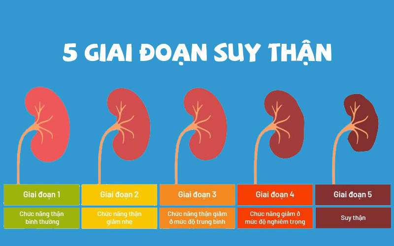 Các giai đoạn của suy thận
