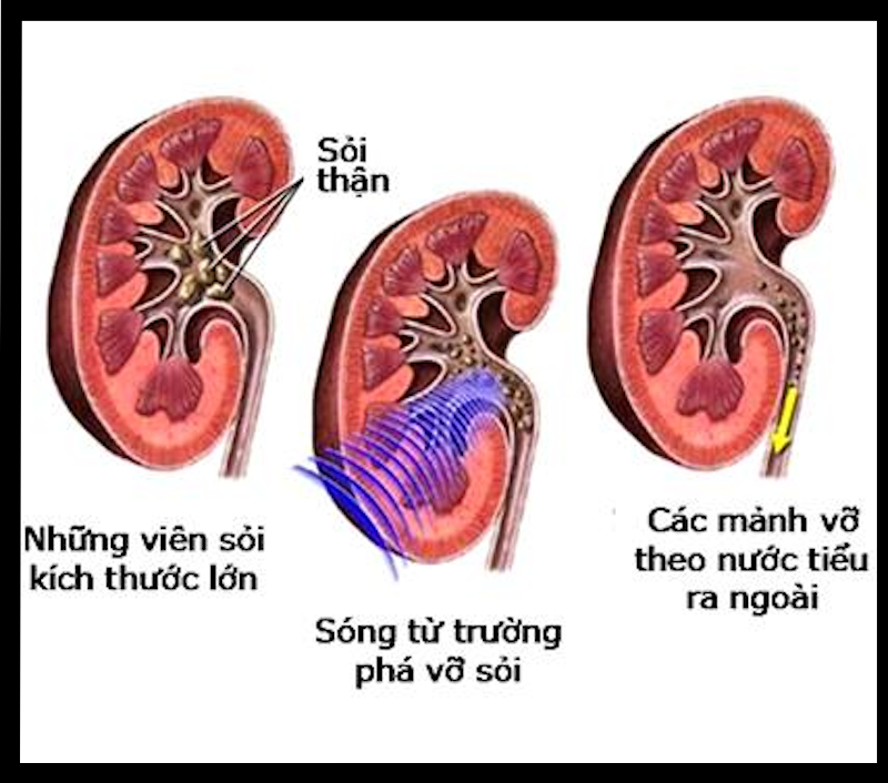 Điều trị ngoại khoa