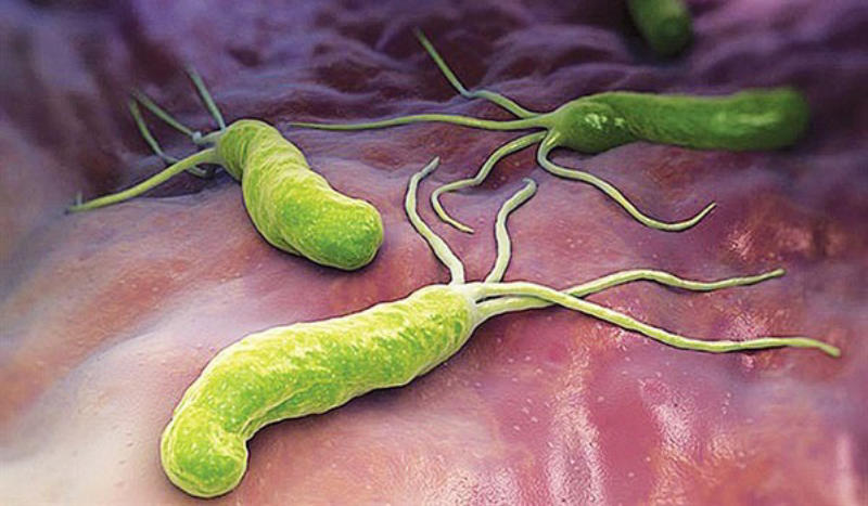 H.pylori là gì?