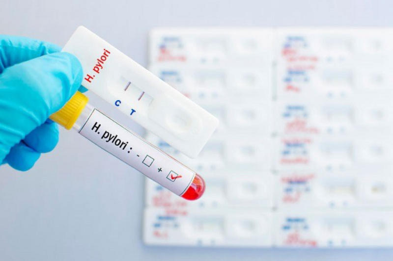 Các cách xét nghiệm vi khuẩn h.pylori