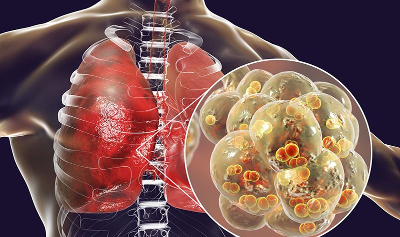 Ảnh hưởng của interleukin 6 trong phản ứng viêm cấp