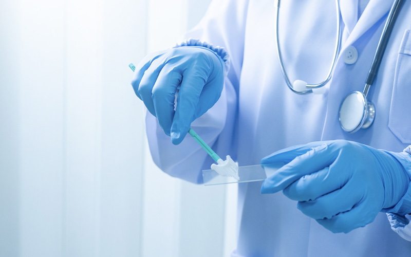 Phương pháp xét nghiệm Pap Smear