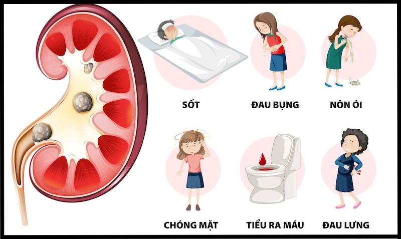 Triệu chứng ở người bị bệnh