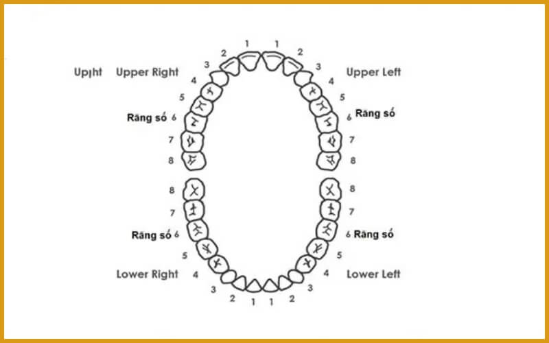Một người trưởng thành có bao nhiêu răng khôn