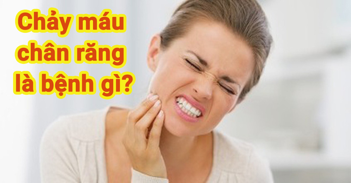 chảy máu chân răng là bệnh gì