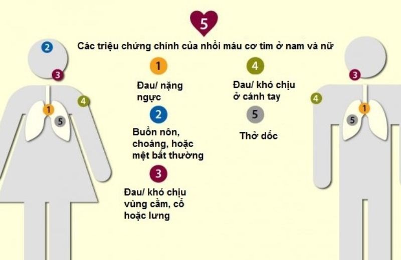 Một số triệu chứng chính của bệnh nhồi máu cơ tim Một số triệu chứng chính của bệnh nhồi máu cơ tim