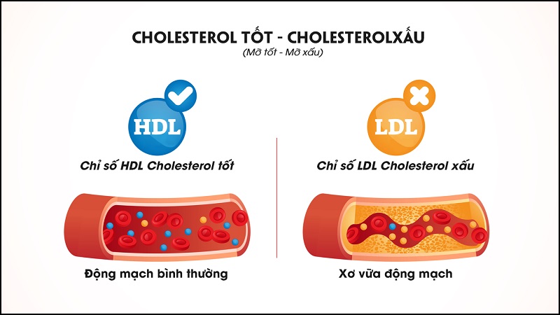 Nồng độ HDL - Cholesterol cao giúp ngăn ngừa các bệnh tim mạch