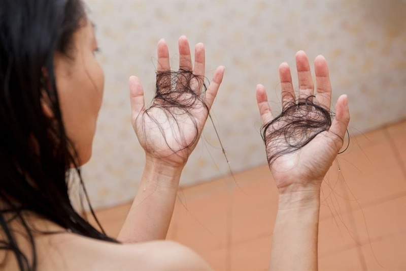 Rụng tóc bệnh lý ở nữ giới