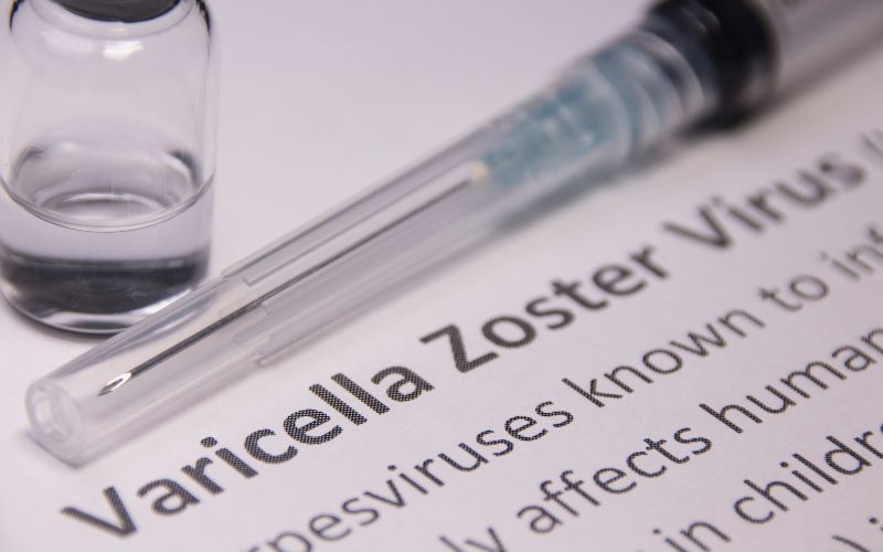 Bệnh thủy đậu do virus Varicella Zoster truyền nhiễm