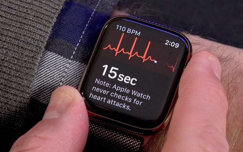 Đồng hồ Apple Watch có chức năng đo điện tâm đồ