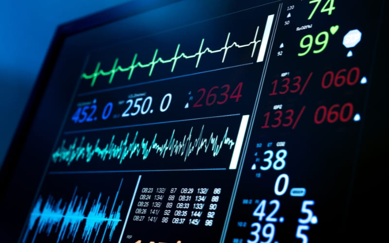 ECG là gì ?