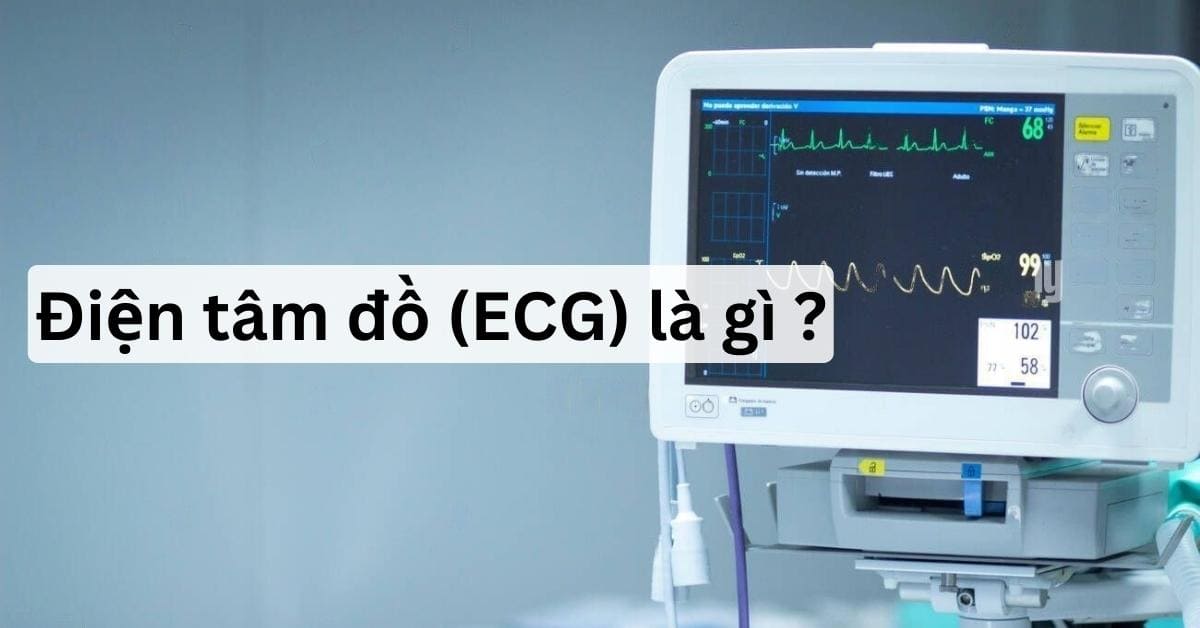 ecg là gì