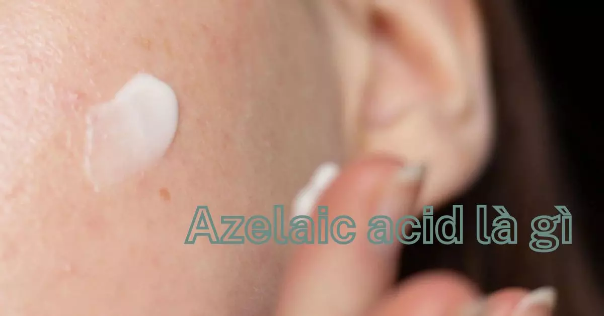 azelaic acid là gì