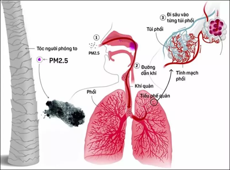 Tác hại của bụi mịn lên sức khỏe con người