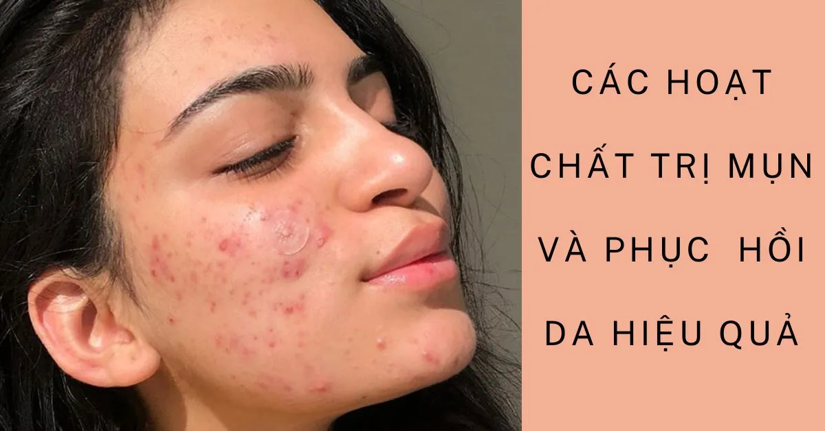 các hoạt chất trị mụn