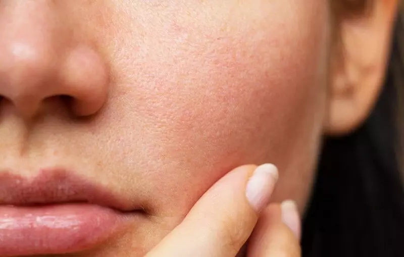 Ngăn ngừa bít tắc lỗ chân lông