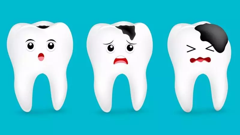 Thiếu chất F men răng sẽ bị yếu