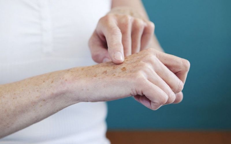 Mất sắc tố sẽ khiến da bị tổn thương