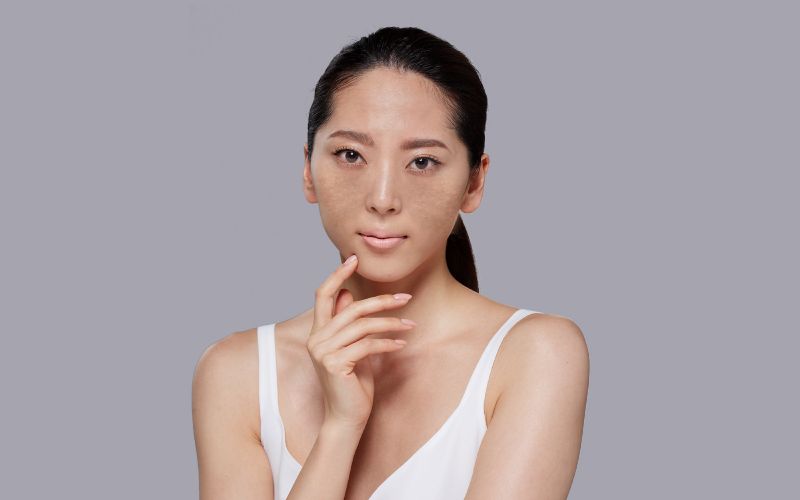 Melanin là một trong những sắc tố mang lại màu sắc cho da, tóc và mắt của con người