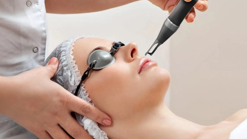 Có thể trị mụn nhanh bằng công nghệ