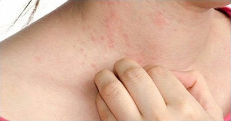 Điều trị bệnh ngoài da