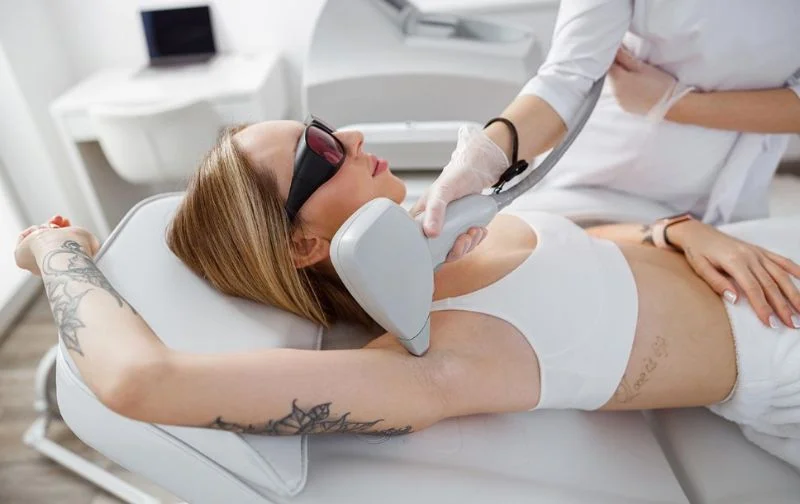 Một số điều cần chú ý sau khi sử dụng công nghệ triệt lông IPL