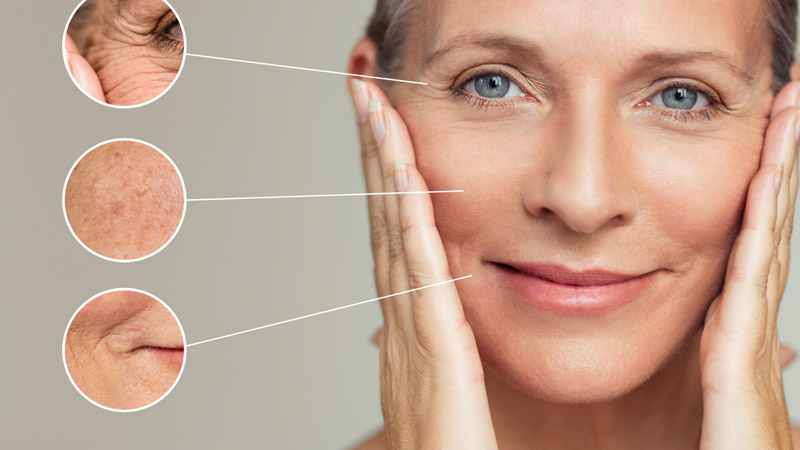 Curcuminoids cải thiện được nhiều vấn đề của làn da