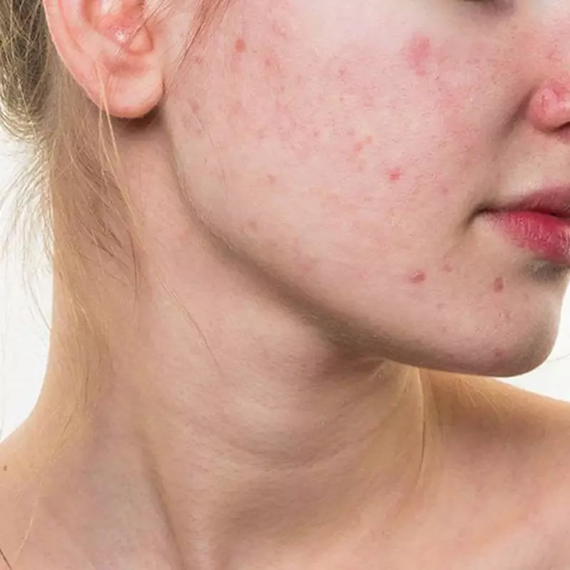 Arbutin thường có tác dụng phụ nhẹ cho da