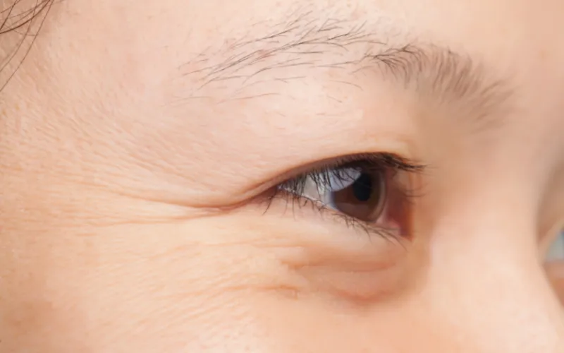 Elastin giúp hạn chế các nếp nhăn